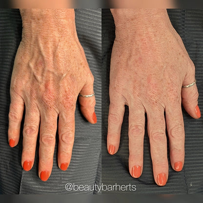 Kiana Anti-Wrinkle Hand Cream